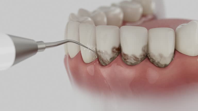 Trusted Tooth Extraction service in Riverdale, IL - Dentist Open Now